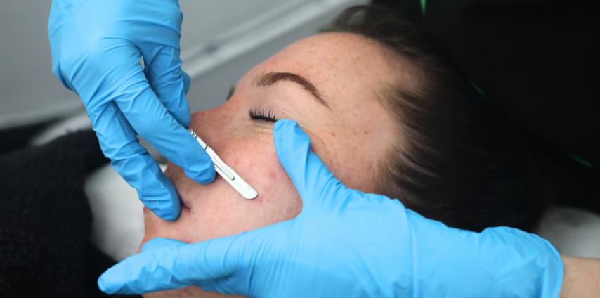 Dermaplaning Plymouth - Service Mobile - Radiant Skincare and Beauty